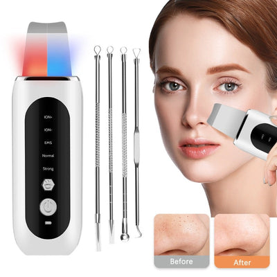 Ultrasonic Skin Scrubber Facial Skin Cleansing Device