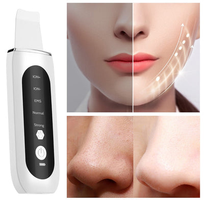 Ultrasonic Skin Scrubber Facial Skin Cleansing Device